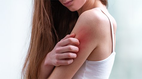 Melyek az ekcéma leggyakoribb típusai, és hogyan lehet felismerni őket?