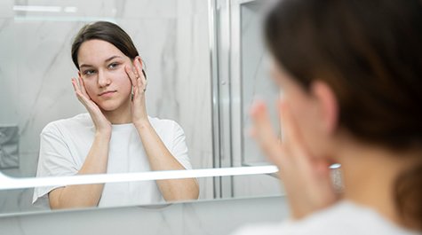 Akne az arcon – Hogyan lehet egyszer és mindenkorra megszabadulni tőle?
