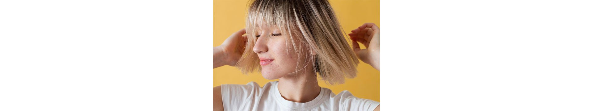 Arcbőr és akné pubertáskorban – Hogyan lehet megszabadulni a pattanásoktól?