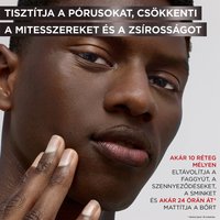 Pure Active Tisztító Gél Mitesszerekre És Pattanásokra - 5