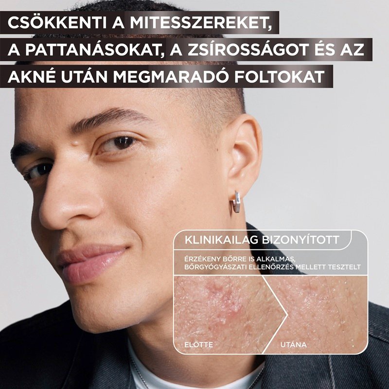 Pure Active Charcoal Szérum - 5